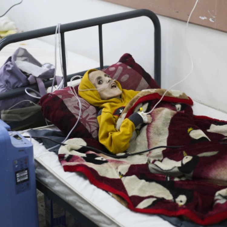 Imagen relacionada de tragedia en gaza nino de 10 anos muere por desnutricion